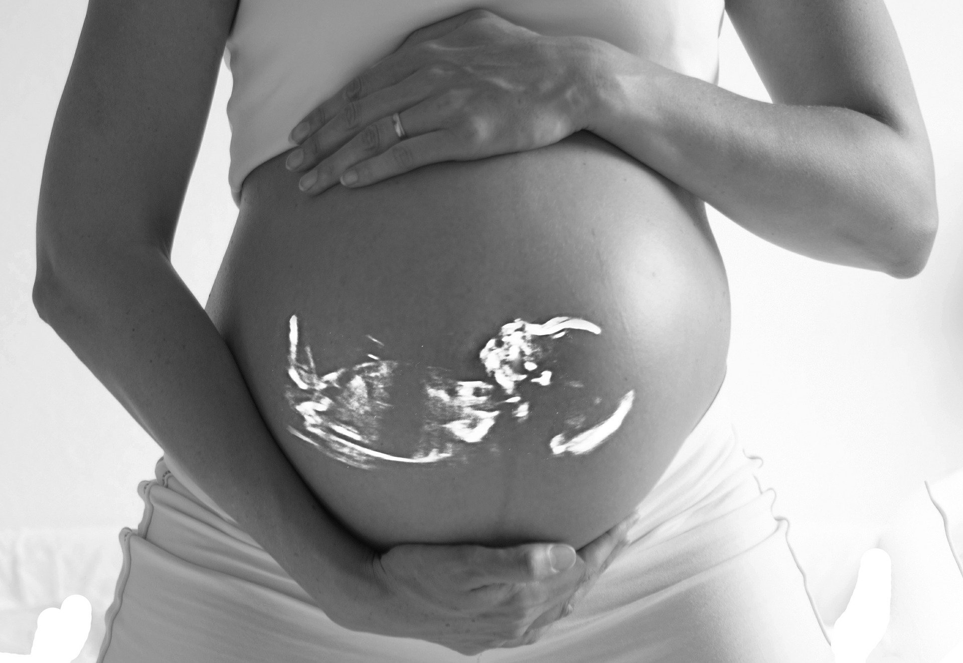 L'échographie au cours de la grossesse
